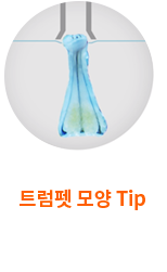 최근 세계의 비절개 방식